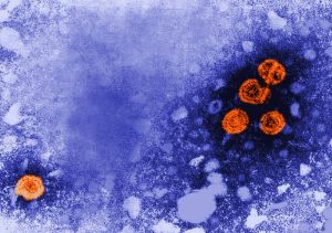 B型肝炎ウイルスの透過型電子顕微鏡の画像