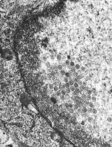 単純ヘルペスウイルスの透過型電子顕微鏡画像