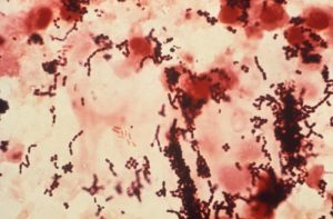 細菌の混合感染の顕微鏡写真