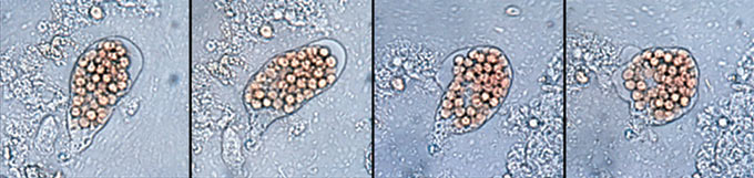 赤痢アメーバの顕微鏡像